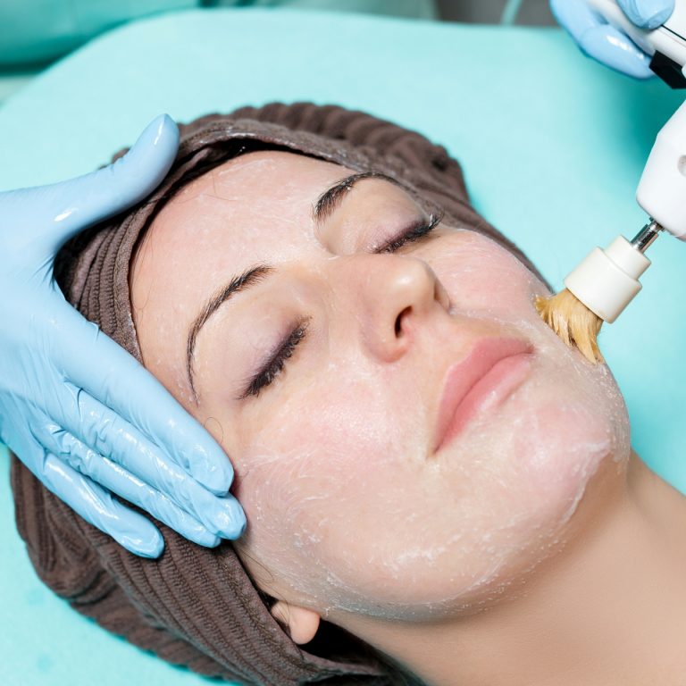 Specialist treating a woman's facial with a diamond peel exfoliating cream.